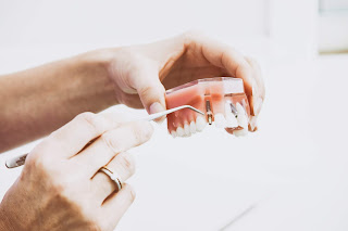 Dental implants when bone is missing