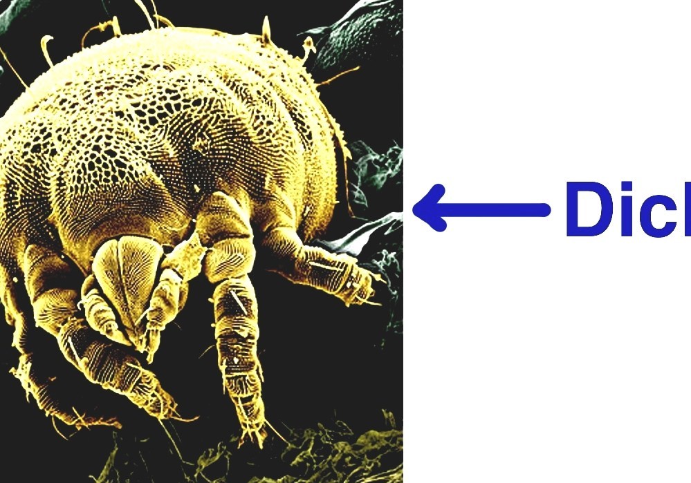 house-dust-mite-can-you-see-dust-mites-with-the-human-eye