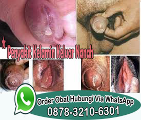 Pengobatan Kencing Nanah Dengan Antibiotik Herbal Pengobatan Kencing Nanah Dengan Antibiotik Herbal
