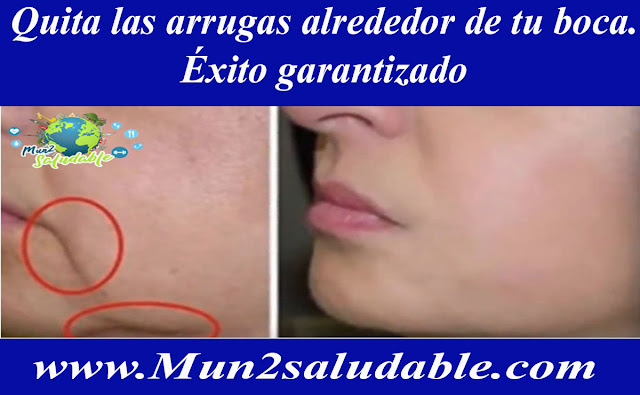 Quita las arrugas alrededor de tu boca. Éxito garantizado Quita las arrugas alrededor de tu boca. Éxito garantizado
