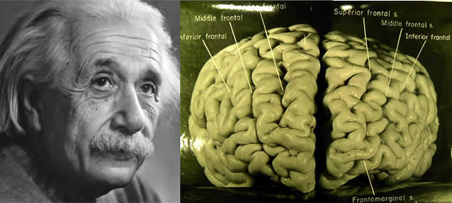 Technology Full Story Albert Einstein S Brain Was Stolen