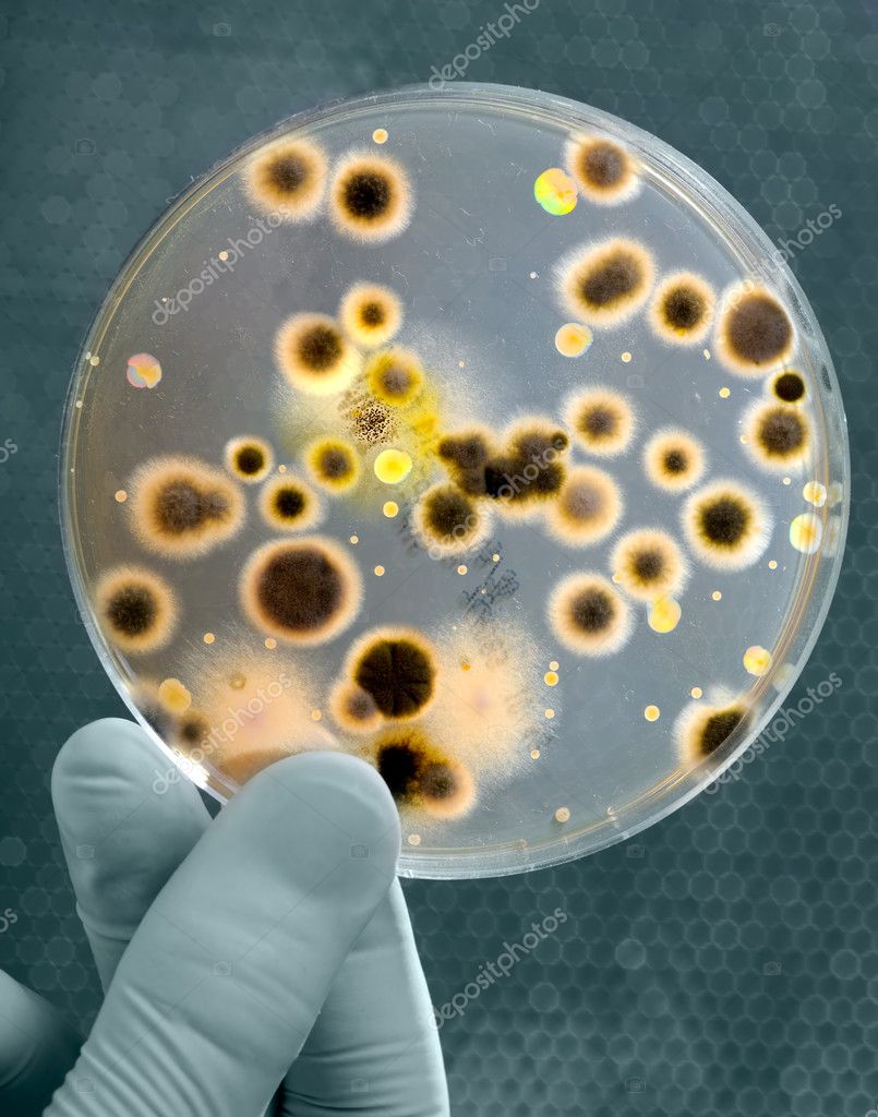 cultivos de bacterias  Un microorganismo se puede sembrar en un medio líquido o en la superficie de