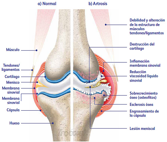 Artritis o artrosis en perros.