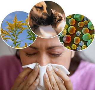 Allergy kitni tarah ki hoti hain? Allergy se kaise bache? Allergy kitni tarah ki hoti hain? Allergy se bachne ke liye kya karna chahiye?