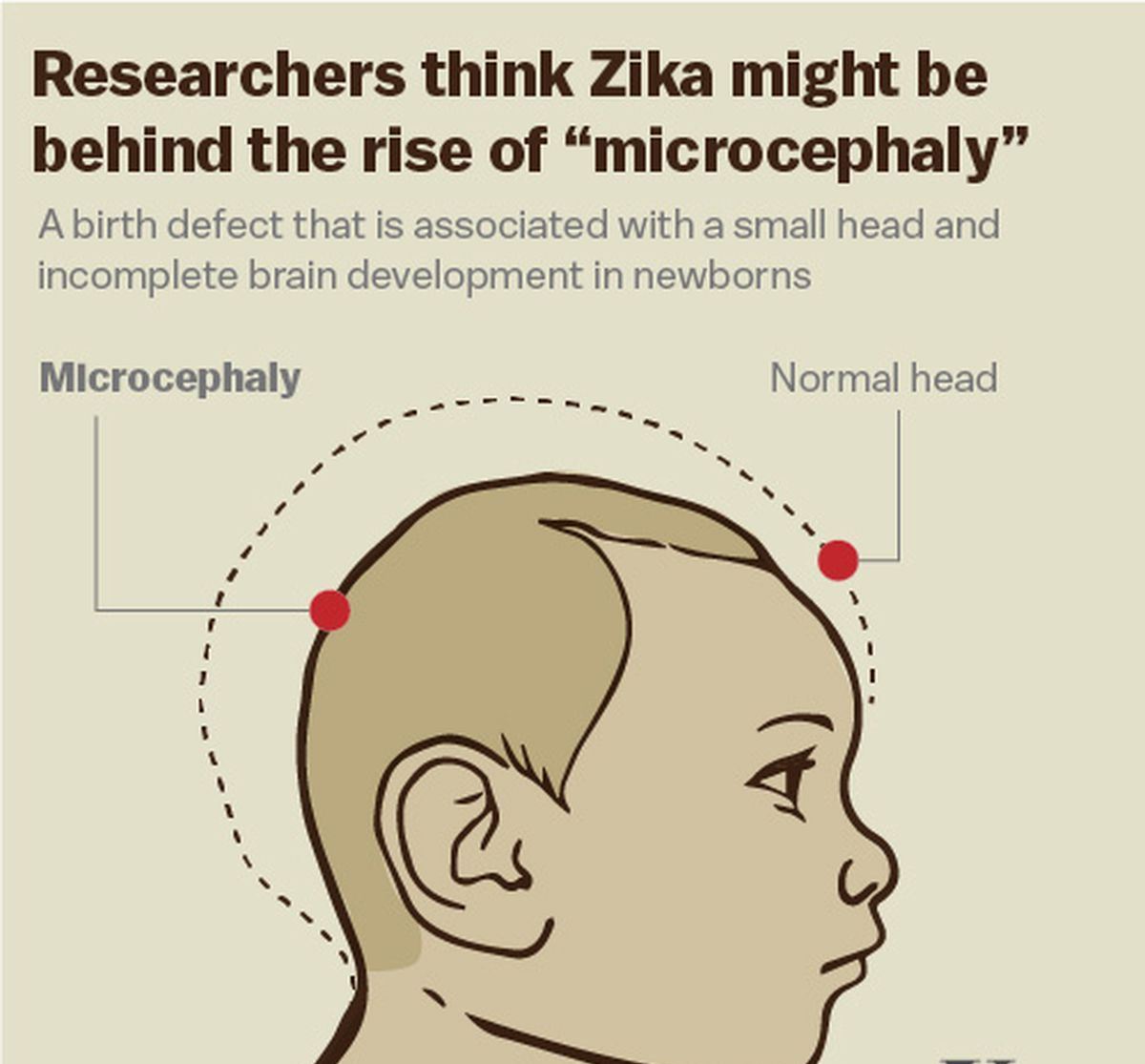 Nbrc Researchers Decipher How Zika Virus Causes Microcephaly