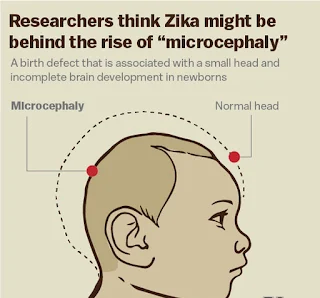 NBRC researches decipher Zika virus causes microcephaly