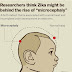 NBRC researchers decipher how Zika virus causes microcephaly