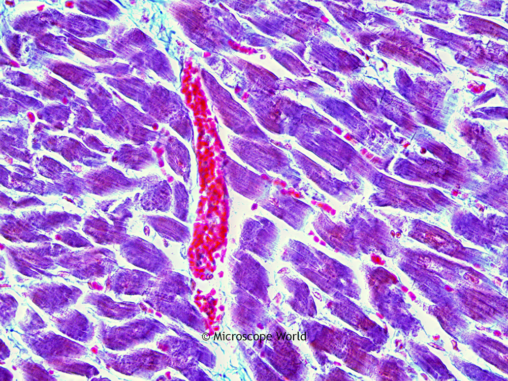Microscope World Blog: Human Cardiac Muscle under the Microscope