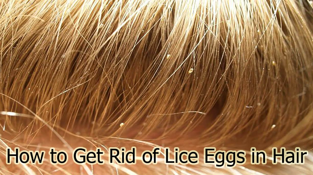 How to Get Rid of Lice Eggs in Hair