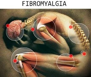 Fibromylagia Pain