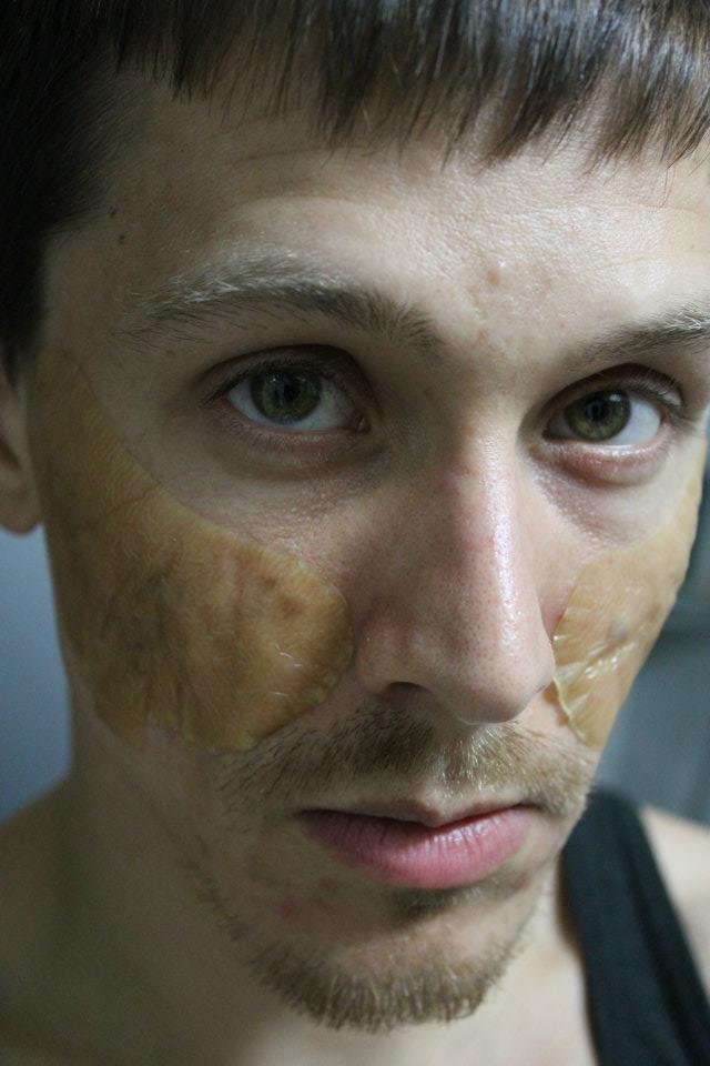 Second Skin: Bandage me up and send me home!