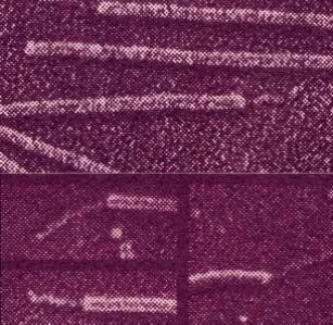 Enterotoxigenik Escherichia coli (ETEC) Enterotoxigenik Escherichia coli (ETEC)