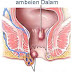 Beli AmbeJOSS Antihemoroid Obat di Apotik thumbnail