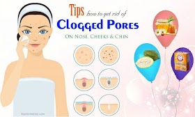 How to Get Rid of Clogged Pores ?