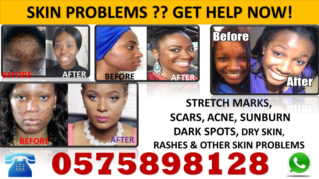 How Can I Get Rid Of Premature Ejaculation Naturally How Can I Get Rid Of Premature Ejaculation Naturally