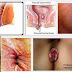 Ambeclear Di Jual Di Apotik thumbnail