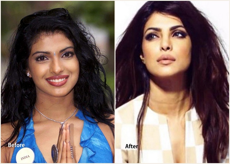 8 Popular Bollywood Actresses Who Underwent Plastic Surgery.