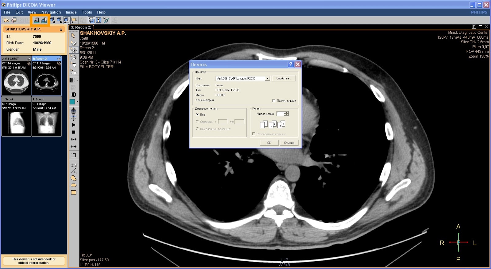 1. Dicom viewer 3. Philips dicom viewer. Philips dicom viewer. Mango dicom viewer.