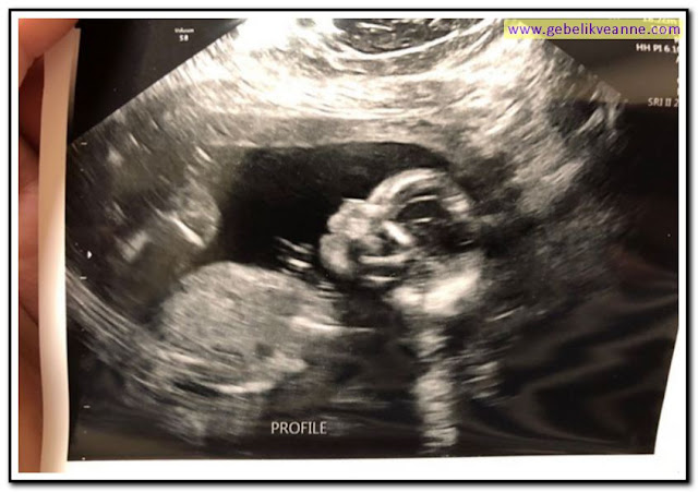 21 haftalık hamilelik (gebelik) 4 boyutlu