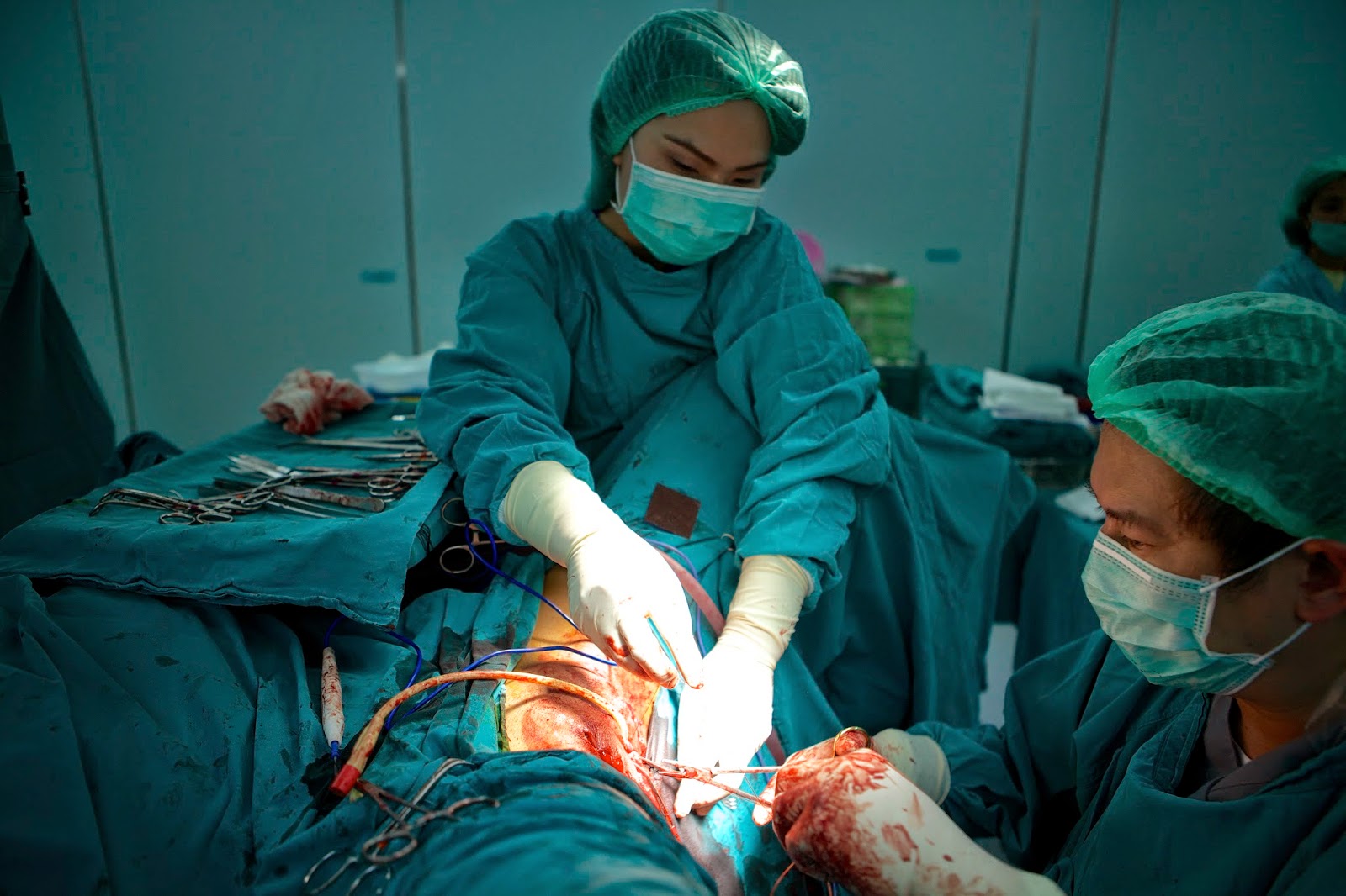 video of a sex change operation video of a sex change operation
