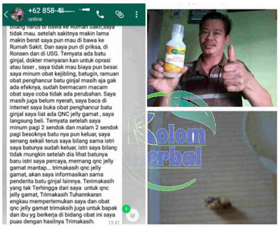 Obat Penghancur Batu Ginjal Terbaik