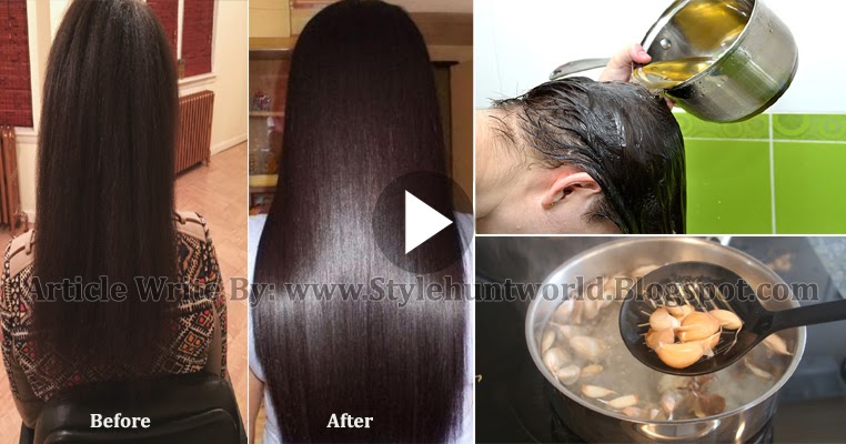Diy Garlic And Coconut Oil Scalp Treatment For Hair Loss Hair