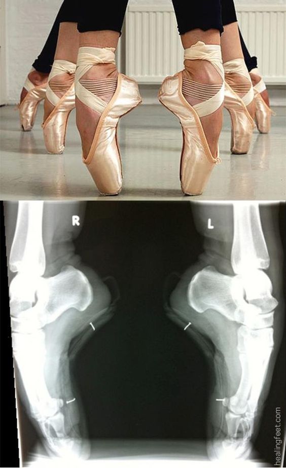 Your Pointe Shoe: A Pointe Shoe Exercise - Tips For Pointe Beginners