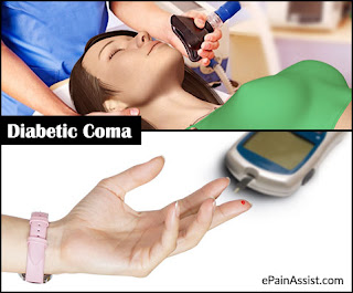 Diabetic Coma