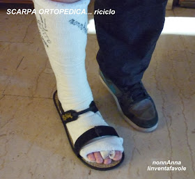 scarpe ortopediche per piede ingessato