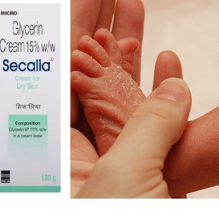 secalia cream