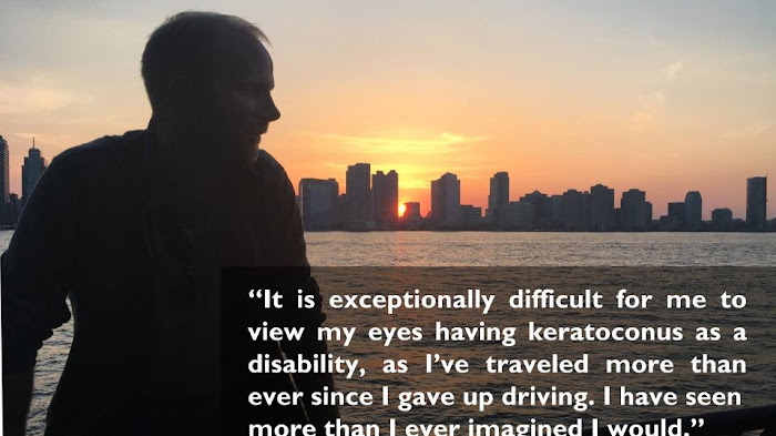 Keratoconus and How it Helped Me See