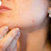 Pimples treatment at home in hindi | मुहासे खत्म करने के घरेलु उपाय