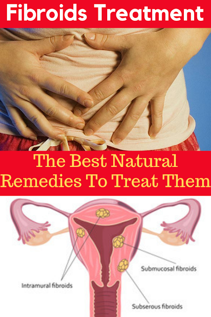 The Best Natural Remedies To Treat Fibroids