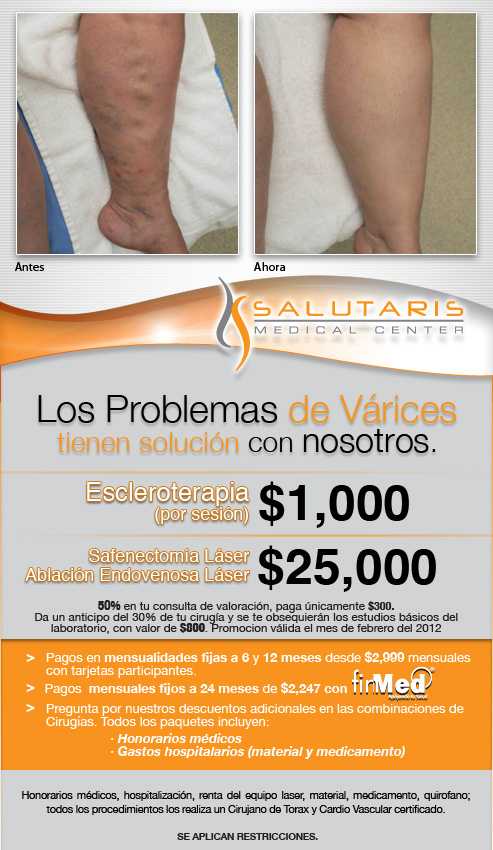 operacion de varices precio guadalajara operacion de varices precio guadalajara