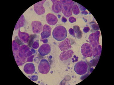 Mikroskopski prikaz limfoma kod psa