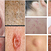 10 signs that cancer is already growing in your body!