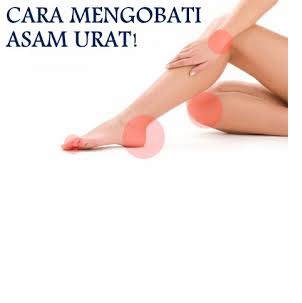 Solusi Penyembuhan Asam Urat Tinggi yang Tepat Solusi Penyembuhan Asam Urat Tinggi yang Tepat