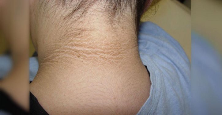 A Mother Notices A Dark Mark On Her Daughter's Neck