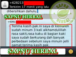 Cara Mengobati Kaki Bengkak Karena Luka Secara Alami Sampai Tuntas Cara Mengobati Kaki Bengkak Karena Luka Secara Alami Sampai Tuntas