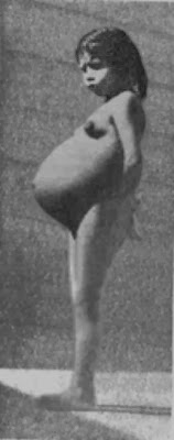 Lina Medina