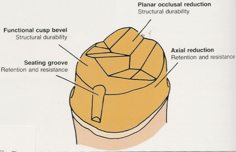 Dentistry and Medicine Full Crowns Restorative Dentistry Lecture Note