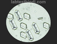 Urine Microscopic -triple-phosphate-crystal