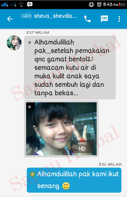 Cara Menghilangkan Bintik Di Bawah Mata Dan Kelopak Mata Sampai Tuntas Cara Menghilangkan Bintik Di Bawah Mata Dan Kelopak Mata Sampai Tuntas