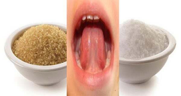 Les capsules lida et