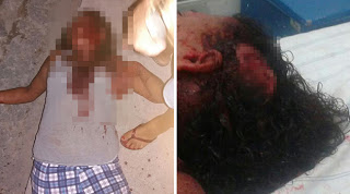 Mulher é agredida pelo companheiro e fica gravemente ferida em Campo Formoso Mulher é agredida pelo companheiro e fica gravemente ferida em Campo Formoso