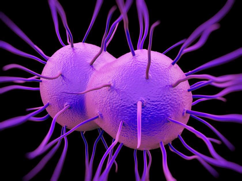 HOW TO PERMANENTLY CURE STAPH AURUES INFECTION AND OTHER INFECTIONS how-to-delete-messages-from-iphone-permanently-full-guide-youtube