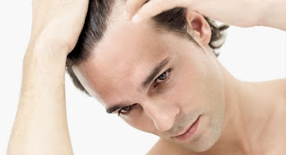 http://sareenhairclinic.com/hair-fall-treatment-delhi.html