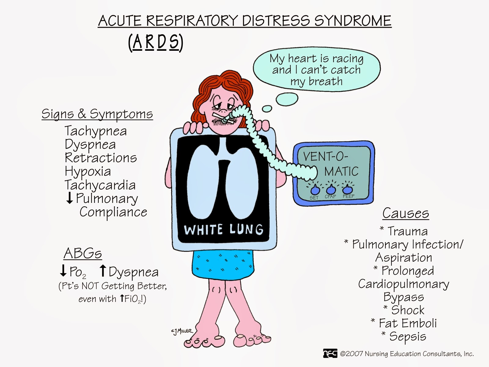 Acute respiratory distress syndrome - Wikipedia