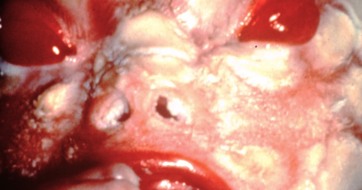 Derm Challenge