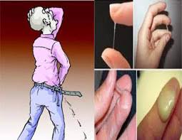 Image OBAT SIPILIS KENCING SAKIT DAN KELUAR NANAH PALING MANJUR